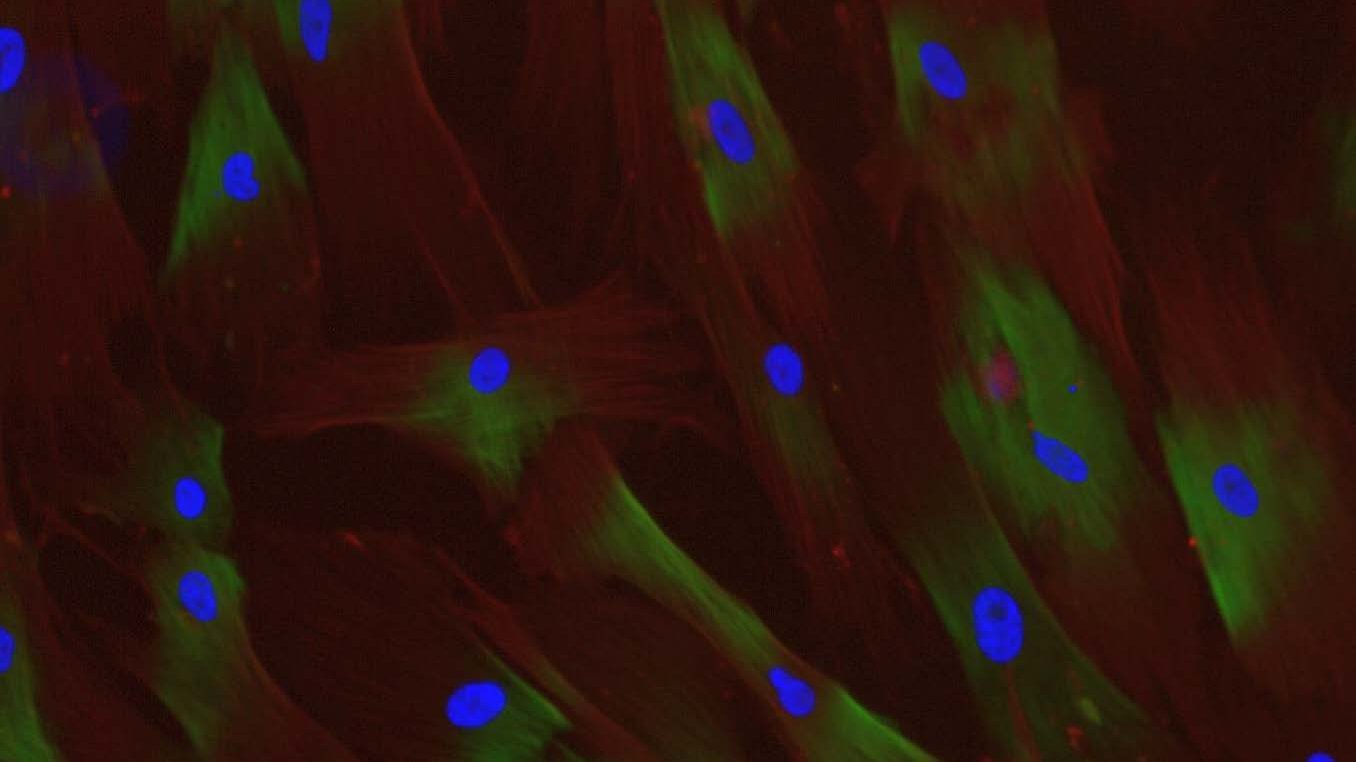 Fluoreszenz-Aufnahmen von mesenchymalen Stammzellen