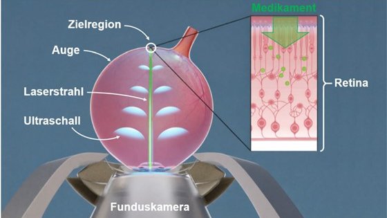 Schematische Darstellung des Vorgangs